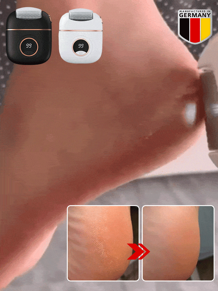 Digital Electric Foot Polisher YT