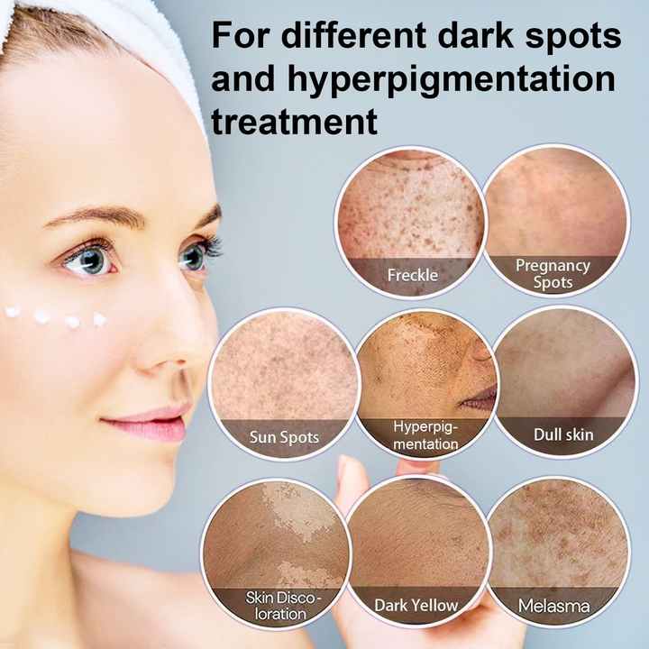 Yujia™ Melasma and Dark Spot Corrector Cream
