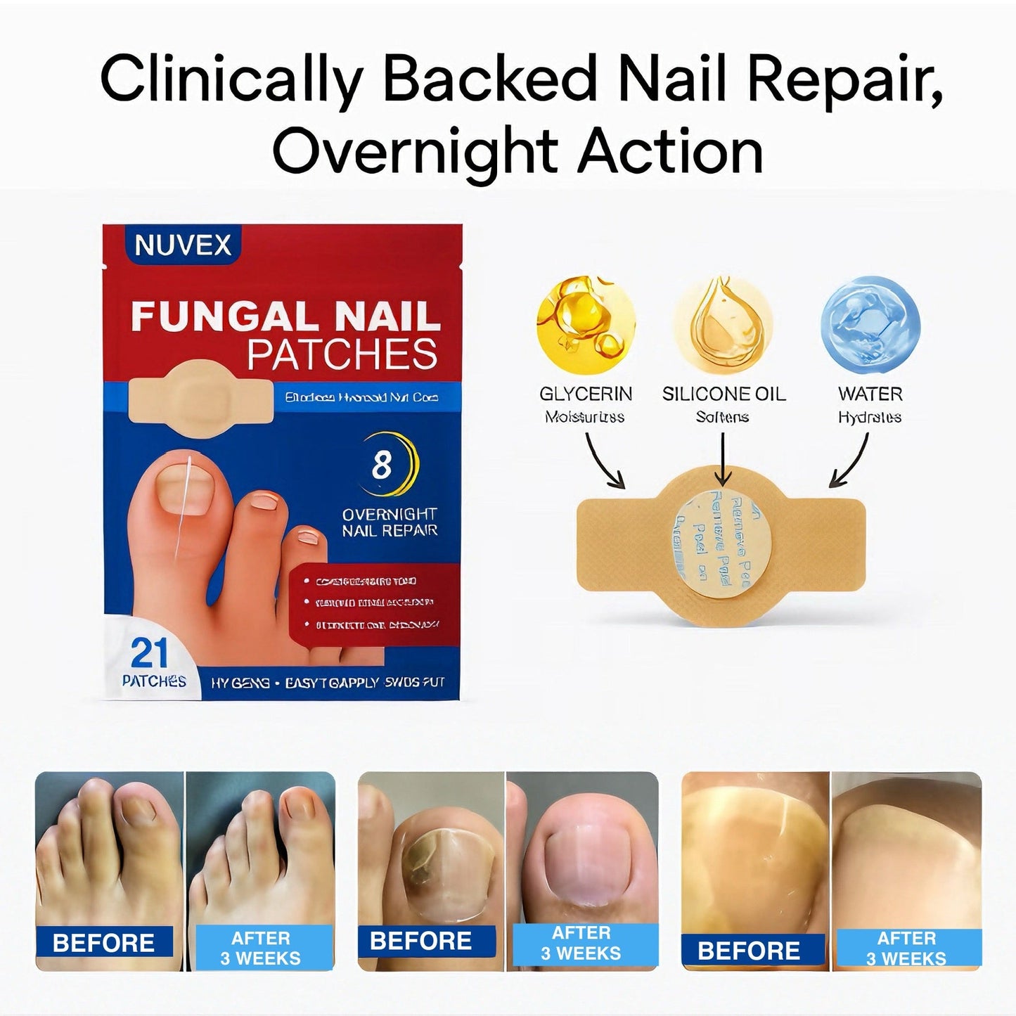Fungal Nail Treatment Patches YT