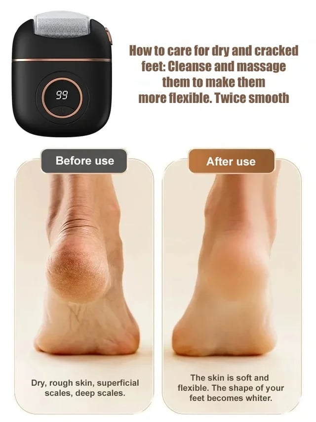 Digital Electric Foot Polisher YT